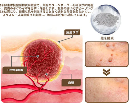 🌸🌸Diapason®:公式ストア 二重効果 植物の疣贅 除光クリーム 👩‍⚕️厚生労働省認定