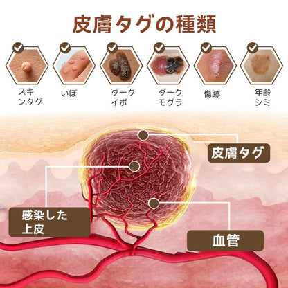 🌸🌸Diapason®:公式ストア 二重効果 植物の疣贅 除光クリーム 👩‍⚕️厚生労働省認定