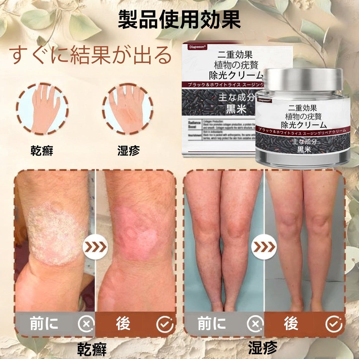 🌸🌸Diapason®:公式ストア 二重効果 植物の疣贅 除光クリーム 👩‍⚕️厚生労働省認定