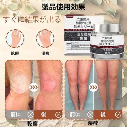 🌸🌸Diapason®:公式ストア 二重効果 植物の疣贅 除光クリーム 👩‍⚕️厚生労働省認定
